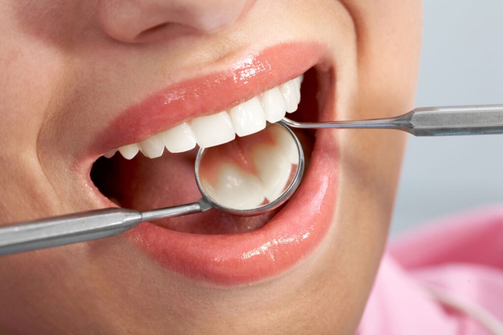 best dental filling in Budh Vihar